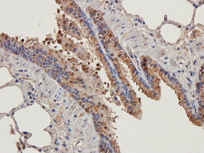 C5b-9 antibody