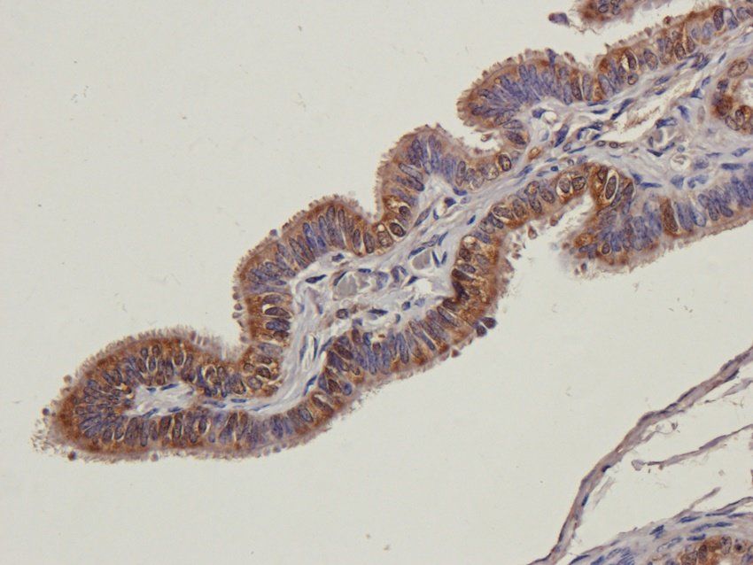 C5b-9 antibody