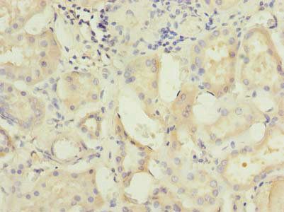 C5orf22 Antibody