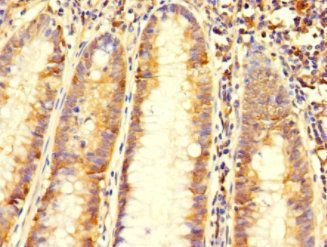 C6orf89 Antibody