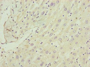 C8B Antibody