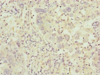 C8B Antibody