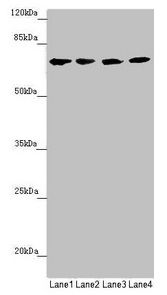 C8B antibody