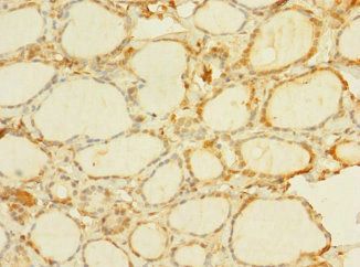 C8orf34 Antibody