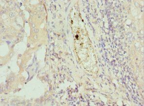 C8orf4 antibody