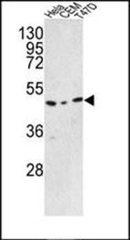 C9orf156 antibody