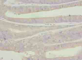 C9orf43 Antibody