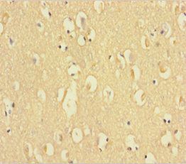 C9orf72 Antibody