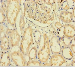 C9orf72 Antibody
