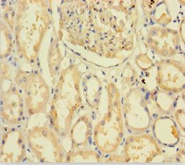 C9orf72 antibody