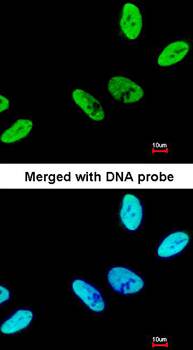 C9orf78 antibody