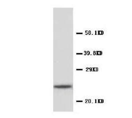 Anti-C Reactive Protein/CRP Antibody