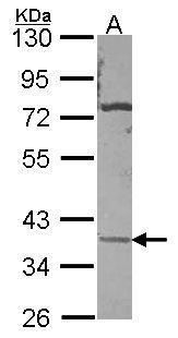 Sodium/Potassium ATPase beta 3 antibody [N2C3]