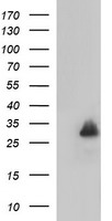 CA12 Antibody