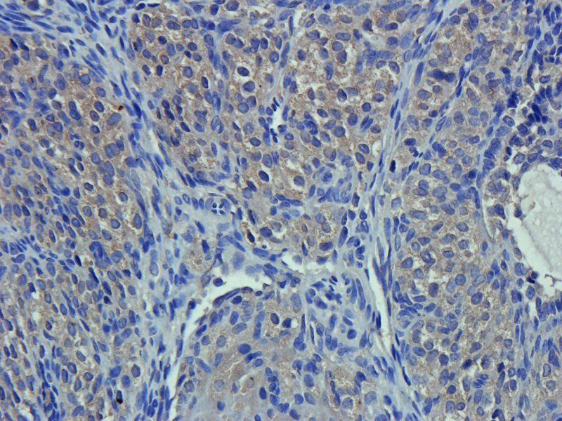 CA125 antibody