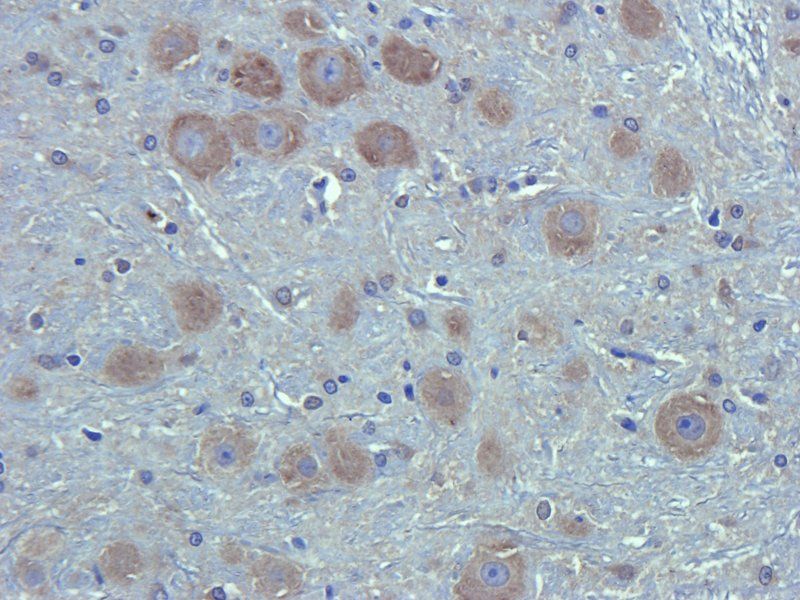 CA125 antibody