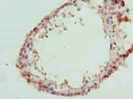 CA3 Antibody