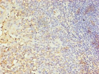CA5B Antibody