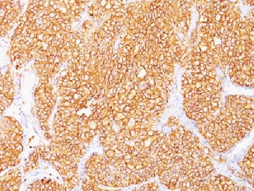 CA9 Antibody