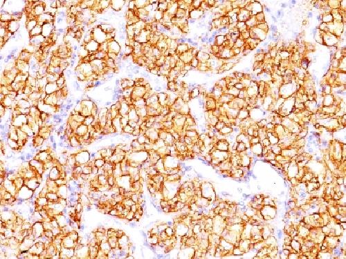 CA9 Antibody