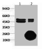 CA9 Monoclonal Antibody