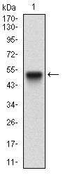 CA9 Antibody