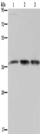 CAB39 antibody