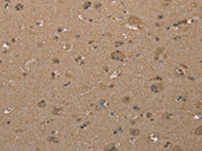 CAB39 Antibody