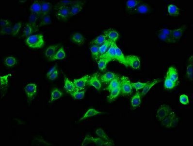 CAB39L Antibody