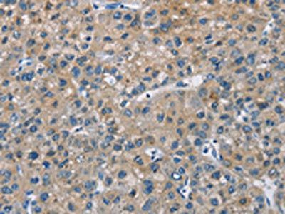CAB39L Antibody
