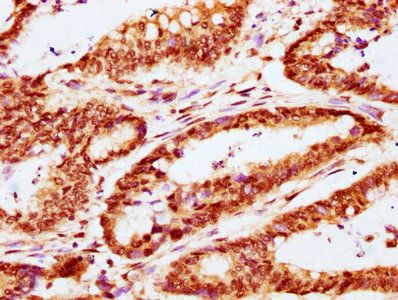 CABIN1 Antibody