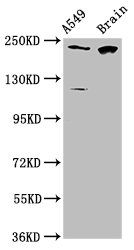 CABIN1 Antibody