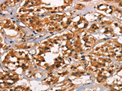 CABLES2 Antibody