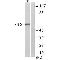 CABLES2 antibody
