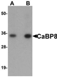 CaBP8 Rabbit Polyclonal Antibody