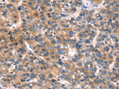 CACNA1A Antibody