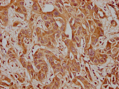 CACNA1A Antibody
