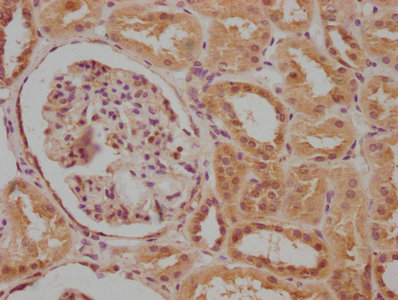 CACNA1B Antibody