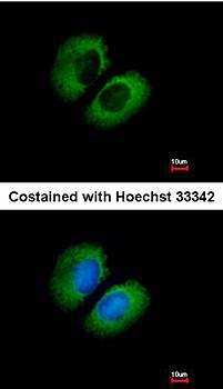 CACNA1B antibody