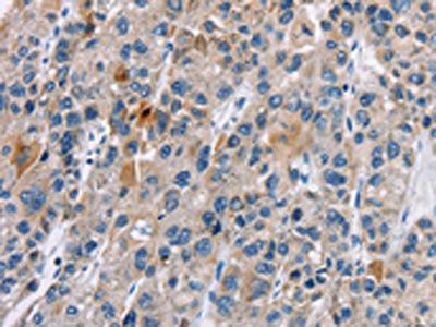 CACNA1D Antibody