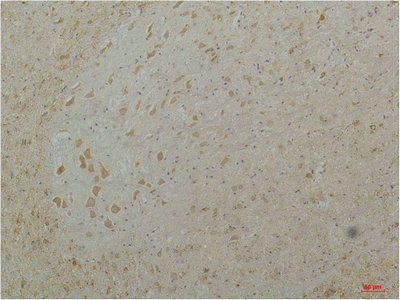 CACNA1D Antibody