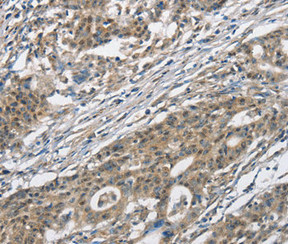 CACNA2D1 antibody