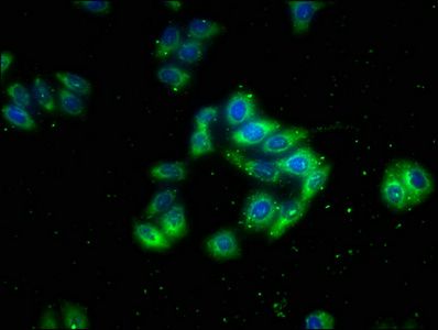 CACNA2D4 Antibody