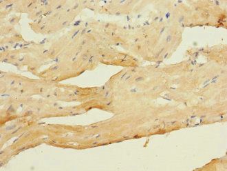 CACNA2D4 Antibody