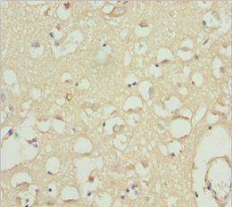 CACNB1 Antibody