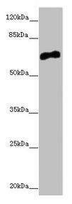 CACNB1 Antibody