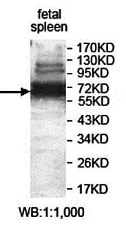 CACNB1 Rabbit Polyclonal Antibody
