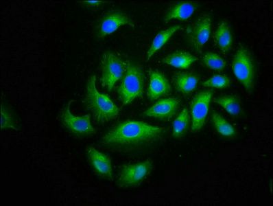 CACNB2 Antibody