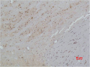 CACNB3 Antibody