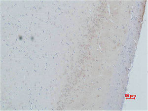 CACNG2 antibody